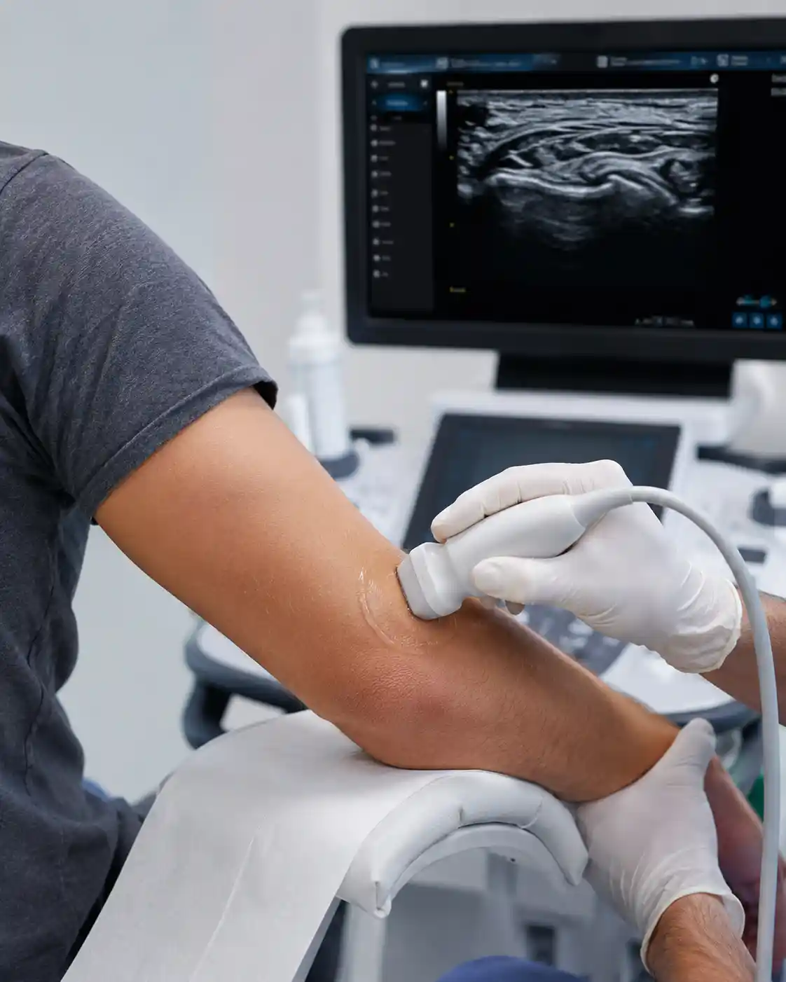 Doctor examining tennis elbow in Chennai clinic