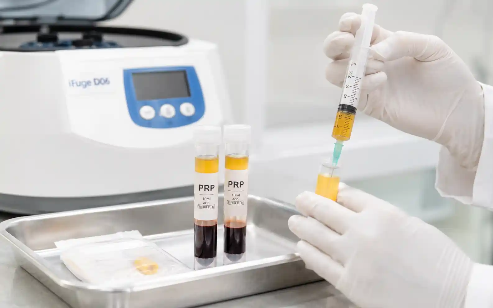 PRP injection for tennis elbow in Chennai