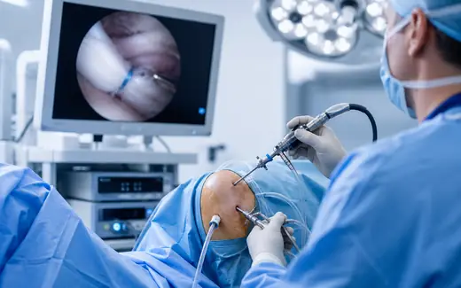 Arthroscopic rotator cuff repair surgery